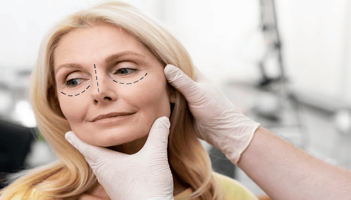 Блефаропластика: секрет відкритого погляду