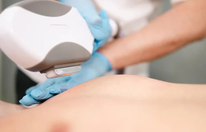 Особливості та обмеження процедури діодного лазера